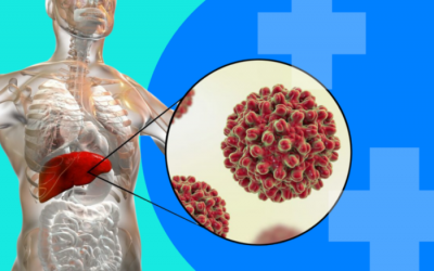 GÓI TẦM SOÁT K - UNG THƯ CƠ BẢN NAM - NỮ