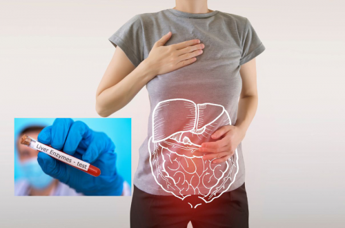 Xét nghiệm chỉ số sức khỏe gồm những gì và ý nghĩa của từng chỉ số