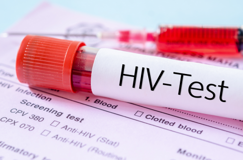 Dịch Vụ Xét nghiệm HIV Tại Nhà