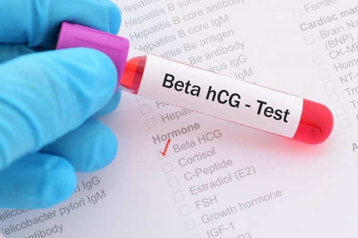 Dịch Vụ Xét nghiệm Beta HCG Tại Nhà